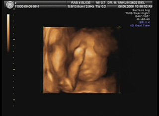Votre Grossesse 25 Semainesfareeda Anklin Echographie Souvenir 3d 4d En Suisse