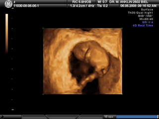 Votre Grossesse 9 Semainesfareeda Anklin Echographie Souvenir 3d 4d En Suisse Votre Grossesse 9 Semainesfareeda Anklin Echographie Souvenir 3d 4d En Suisse